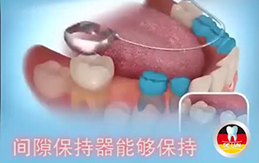儿童乳牙早失的法宝：牙齿间隙保持器