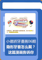【小德矫牙期06期】隐形牙套怎么戴？
